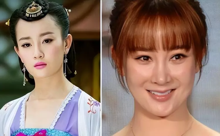 医美|出道即惊艳众人,现在却灵气全无,是花期太短还是医美太过?