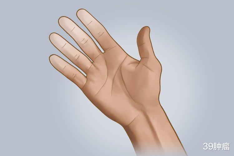前列腺癌|男性右手无名指长于食指,患前列腺癌风险高?是科学还是谣言