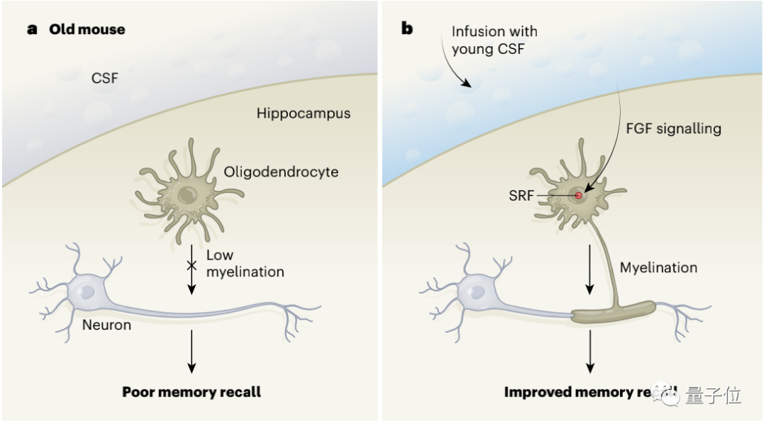 大脑衰老可逆转，只需注入年轻脑脊液，“返老还童”登Nature