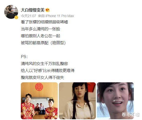 张檬|整容、当小三、嫁渣男？张檬和小五结婚，却收获一片骂声？