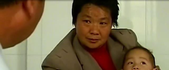 河南1岁半女童疑似怀孕,检查后在腹中发现胎儿,手术现场惊呆医生