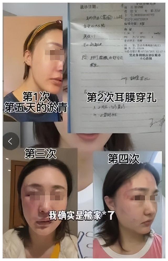 千万粉丝女网红自曝遭家暴,2022年已有多名网红遭家暴