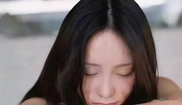 女孩因拒绝和富二代交往,被重度烧伤,抢救了七天七夜才重获新生