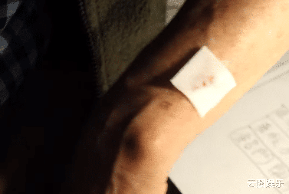 TVB|TVB艺人拍戏频繁受伤!刘家良徒孙头撞玻璃,紧急送医后缝8针