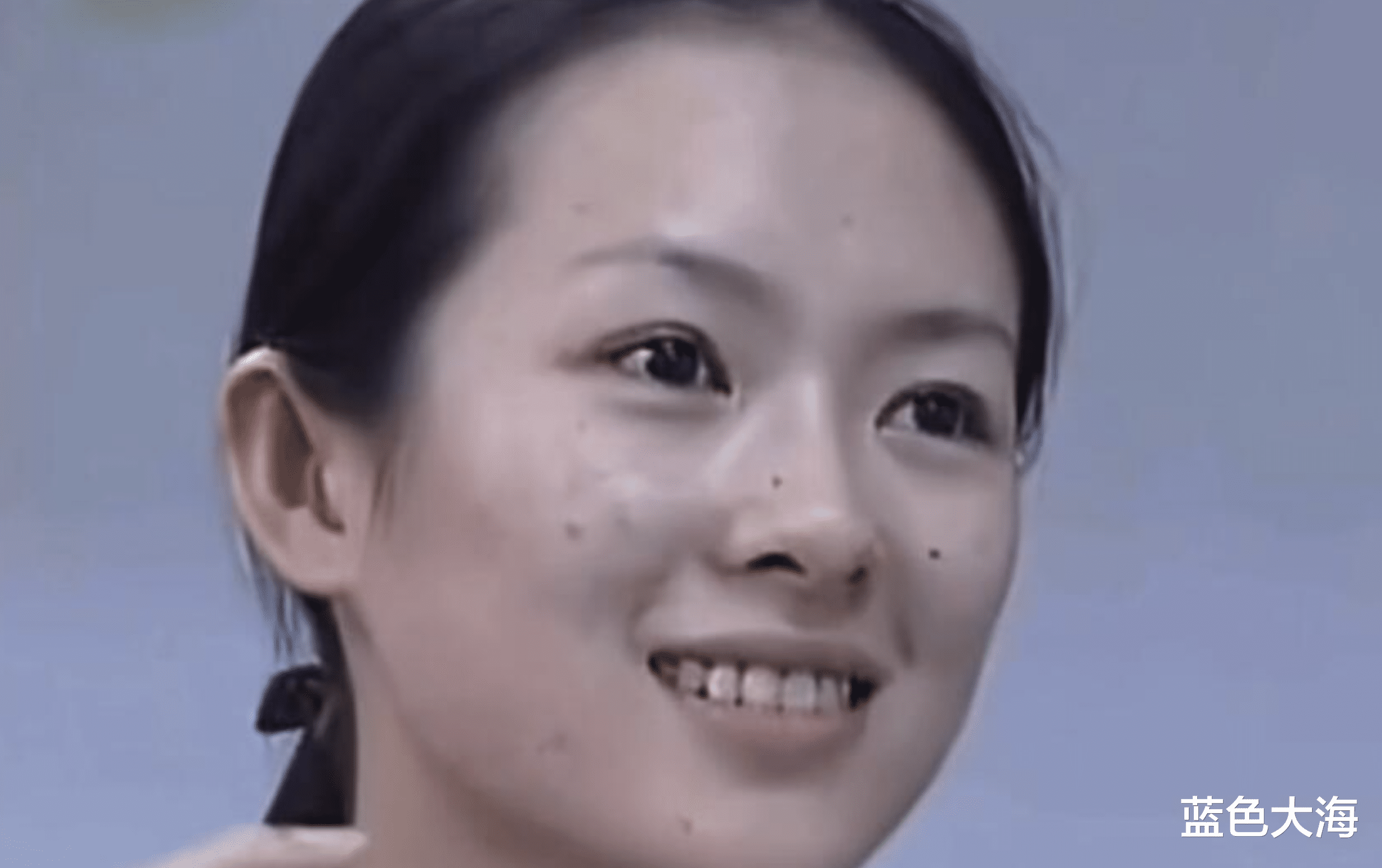 痘痘 10位有“上镜脸”的女星，真人干瘪黑瘦，荧幕上艳光四射，反差大