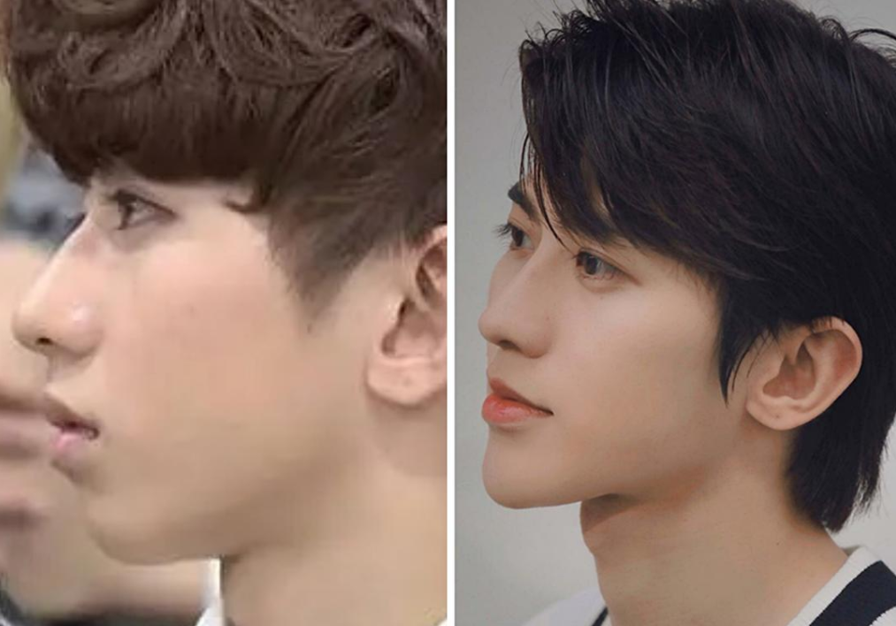 演艺圈|演艺圈“花式假下巴”大比拼，又尖又翘，一个比一个精彩