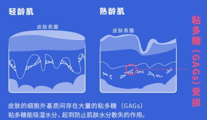 玻尿酸 过了30岁多保养这几个地方，人会显得年轻很多