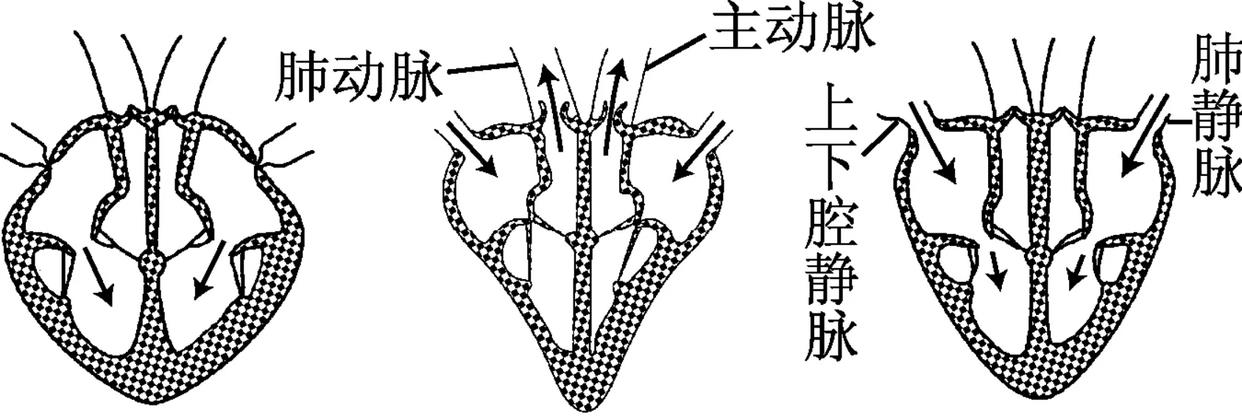 人死后会去哪里?死后仍会有意识,大脑会继续运行?