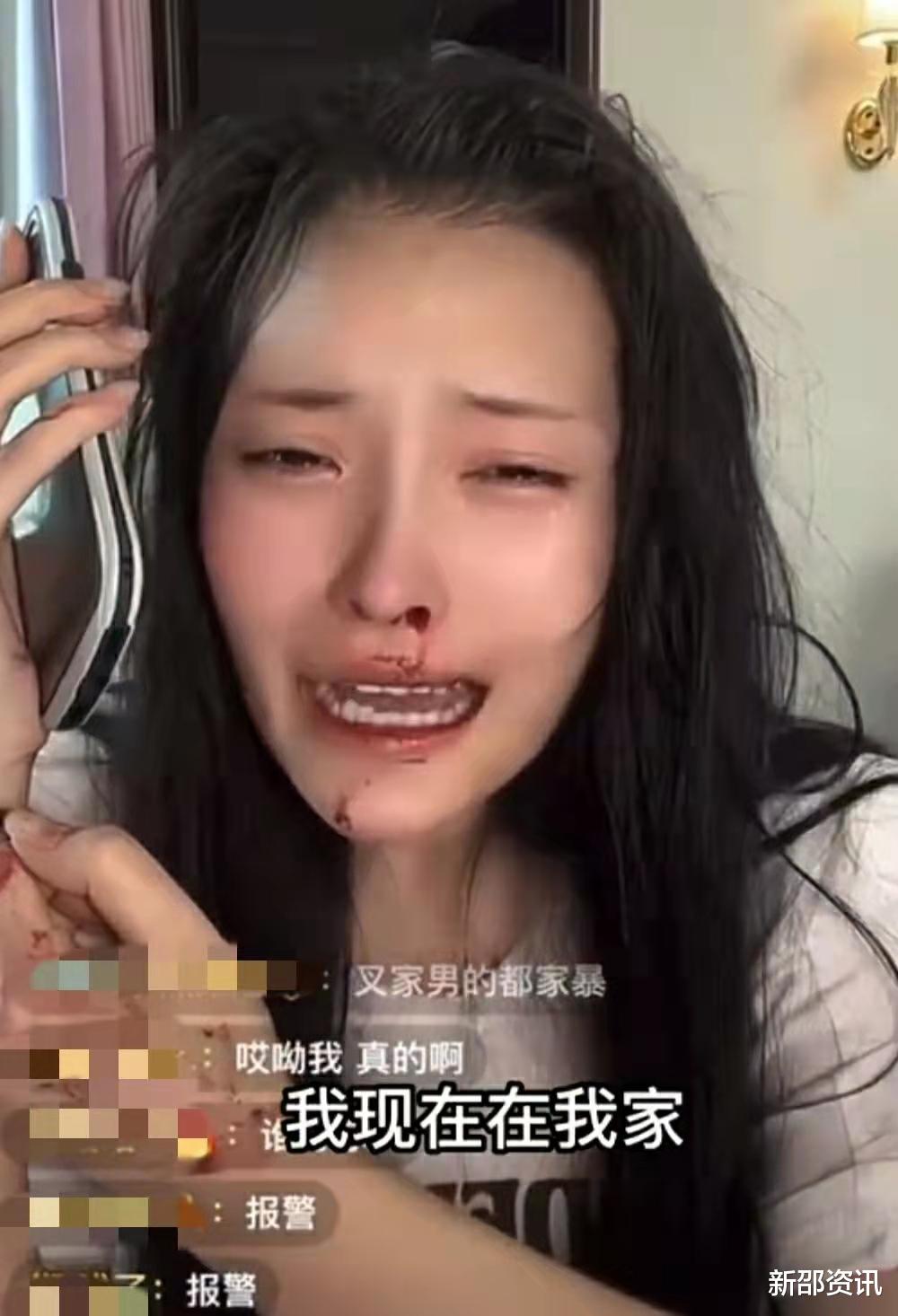 气愤!美女网红被男友暴打,满脸血边直播边报警,男友被扒是惯犯