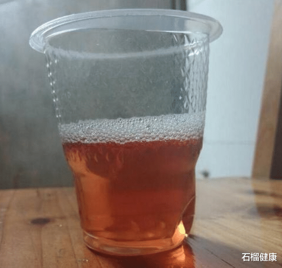 按摩|肾功能受损，往往离不开3大原因，趁早改正，或能保护肾脏