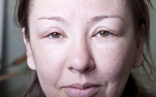 雌激素|肾不好的人,身体可能有“2黑2臭”,若你1个不占,或许肾还不错