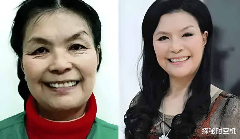 整容|2012年,六旬太婆为寻初恋情人“隆胸整容”,是真爱还是炒作?