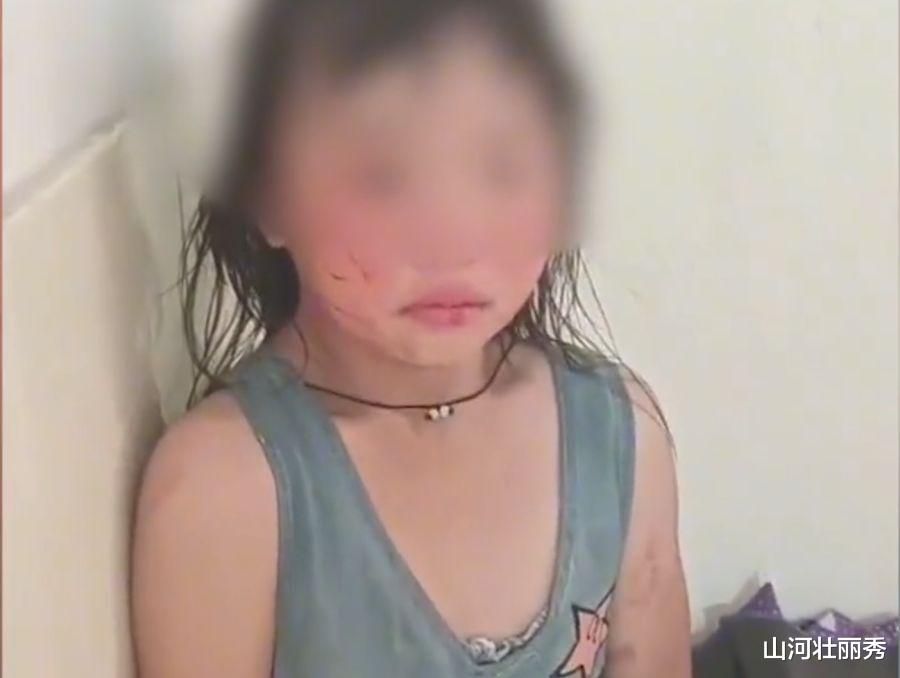 泯灭人性!6女孩被后妈殴打却不敢哭,只因哭闹会继续被打!