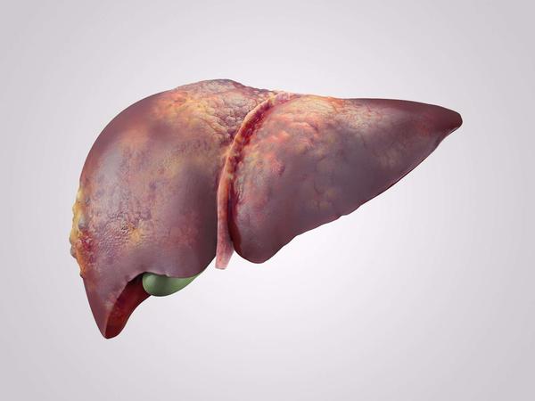 脂肪肝|体检查出中度脂肪肝，不用慌，日常做好这3个调理措施可控制病情