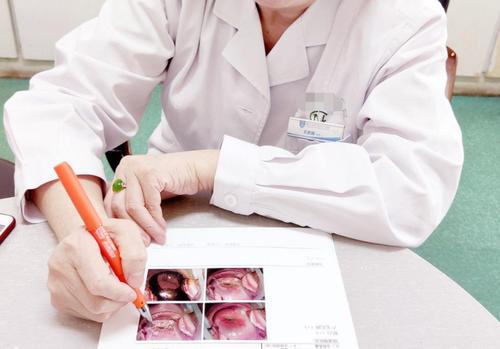 咳嗽|HPV的“祸首”找到了,妇科主任:若想hpv早日转阴,2种食物或可多吃