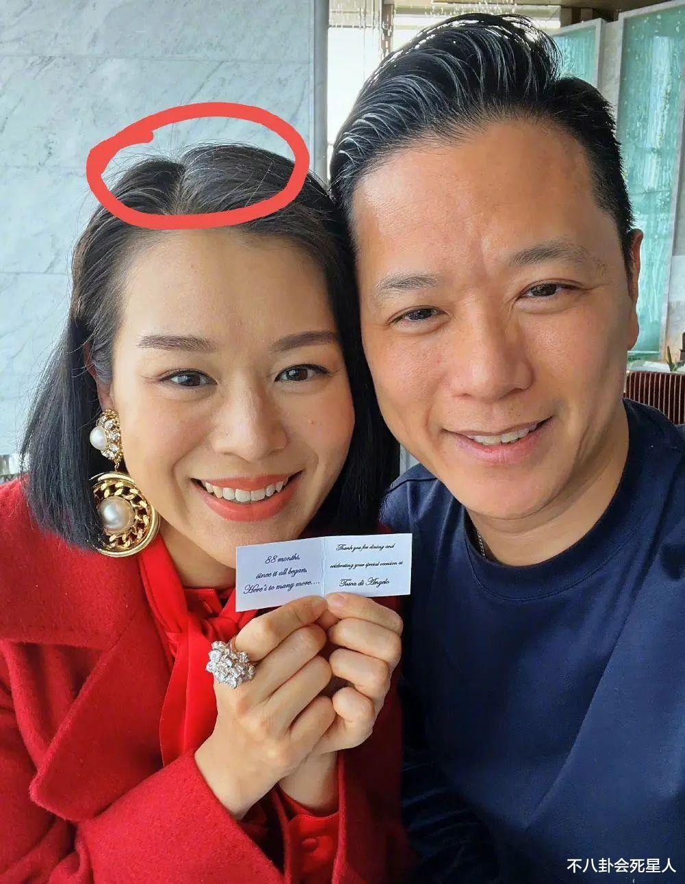 |生完孩子大变样的10位女星，秃头白发，脸垮眼睛凹陷，太可惜了