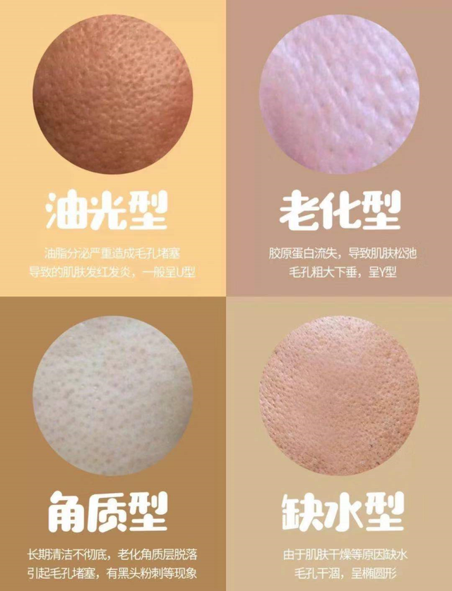 宝洁 改善毛孔粗大的几个诀窍，让你素颜也自信