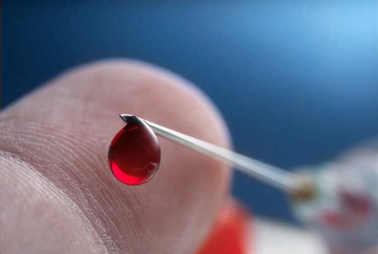 基因|父亲O型血,母亲A型血,小女儿却是B型血?父亲的内心崩溃了