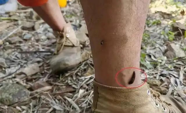 骨质增生|蚂蟥为什么遇盐就化为一滩血水?它能在我们体内生存吗?