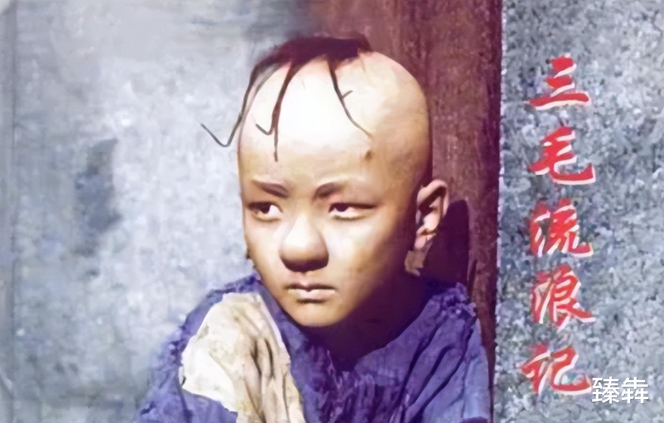 |童星“三毛”34岁了!8岁爆火14岁谢顶,植发挨300多针,今成帅哥