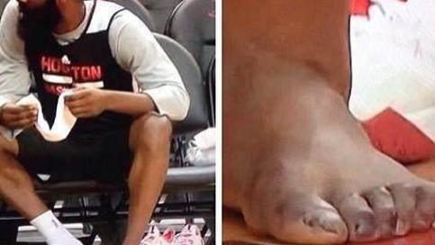 科比·布莱恩特|当你看完哈登的脚趾，科比的手指，姚明的膝盖，你还羡慕NBA的高薪吗？