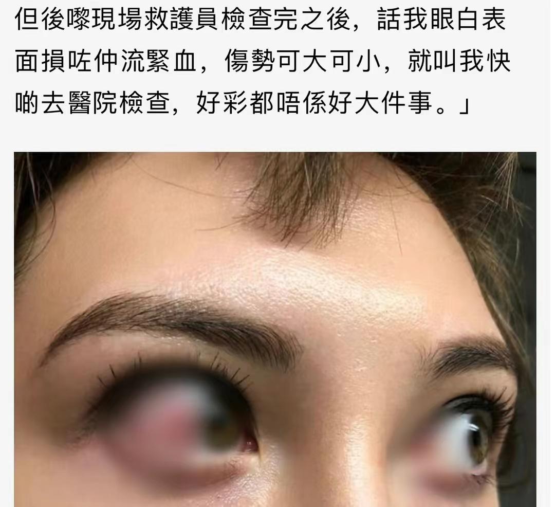 电影|31岁港星被灯砸破头！血流满面衣领被染红，紧急送医后仍坚持拍戏