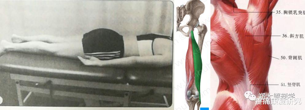 运动|肌肉失衡模式的经典动作评估与分析