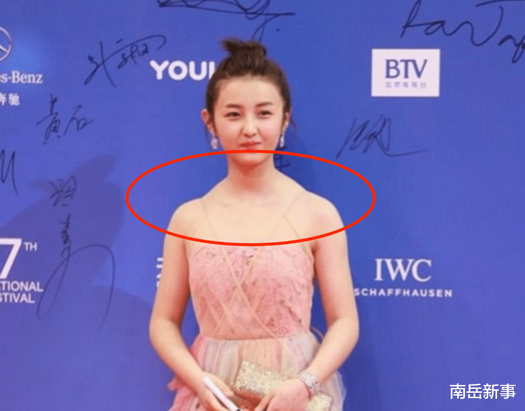 蝴蝶骨|直角肩、漫画腿、蝴蝶骨，女星引以为傲的身材，其实病态又畸形