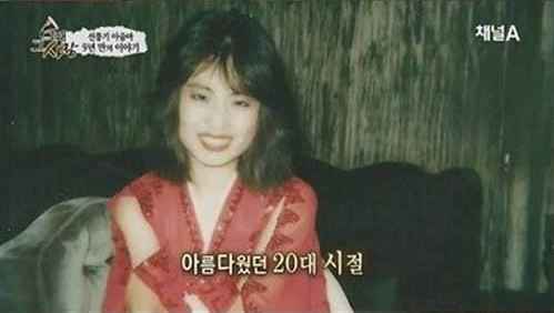 韩慧景|女星韩慧景：为了更漂亮，给脸注射食用油，把脸整成“猪头”