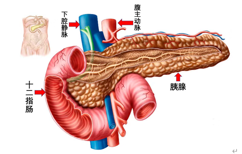 肠息肉|“胰腺癌”为什么喜欢装“胃痛”，医生告诉你哪种情况要警惕！