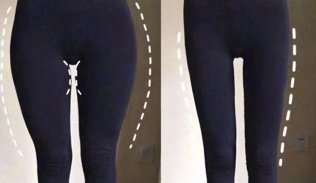 戚薇|“少女胯”与“妇女胯”有何区别？看当红女明星的站姿，一目了然