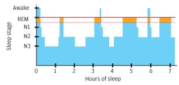 睡眠|睡得多不如睡得好!4个有效建议,帮你远离失眠和抑郁