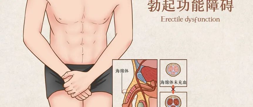 治疗阳痿,早泄,遗精,难育的12种中成药(一次讲清楚