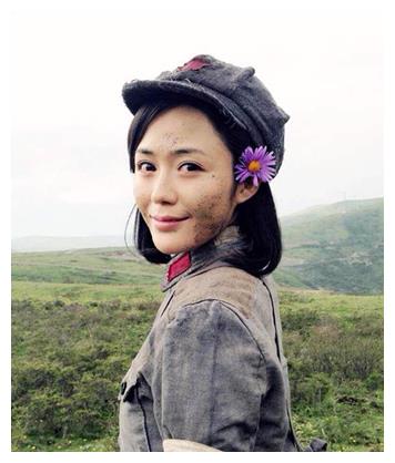 脸没恢复就别接戏了，“馒头脸蛋”演啥都拉胯，这些女星不羞吗