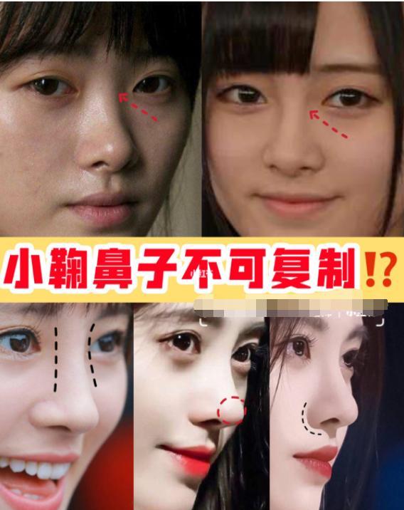 整容|明星“假鼻子”大PK，帅哥变丑男，美女变女巫，谁越整越残？