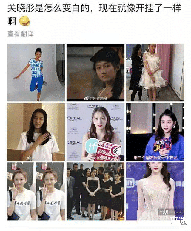 防晒衣 娱记曝关晓彤定期去打美白针，因身体受到影响，露面都靠全身擦粉