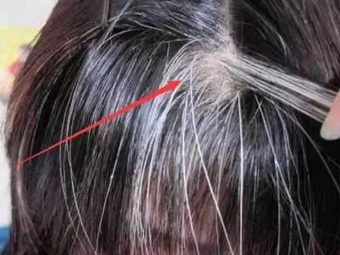 红薯|前额白发调脾胃，两鬓白发调肝胆，头顶白发调哪里？