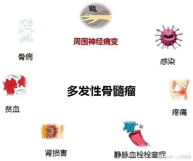 多发性骨髓瘤|多发性骨髓瘤患者的9大关注