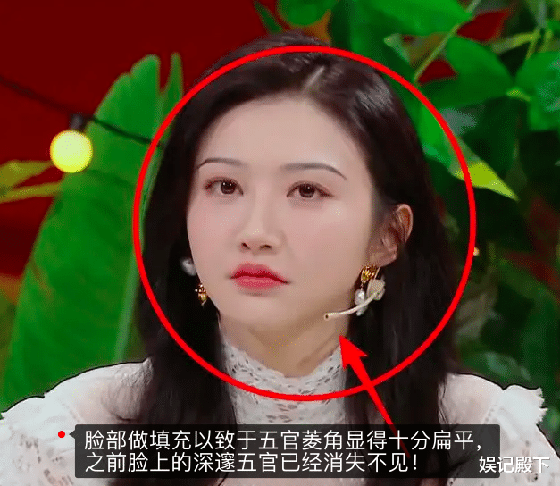 景甜|景甜整容大变样,脸部僵硬微笑唇太违和,人间富贵花可惜了!