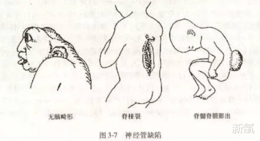 朱之文|被冤枉了十几年，她终于肯站出来为自己说话了…
