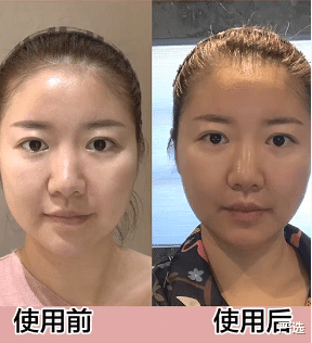 刘亦菲 刘亦菲素颜变“直男斩”,自曝在家使用美容设备,网友:确实好用