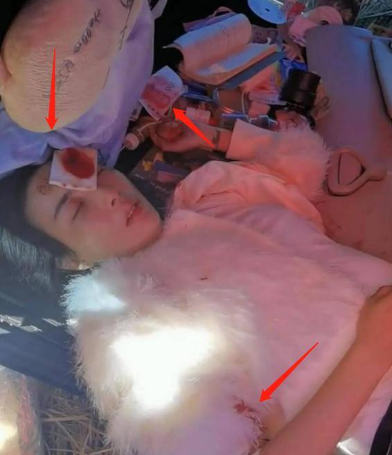 刘惜君|被车祸伤害的11位明星，有人风华正茂就离世，有人盛世美颜遭毁容