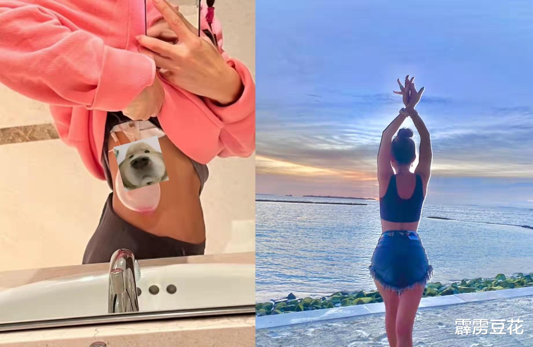 李玟|48岁李玟体重不足85斤!晒照露出引流袋,健康状况引人担心