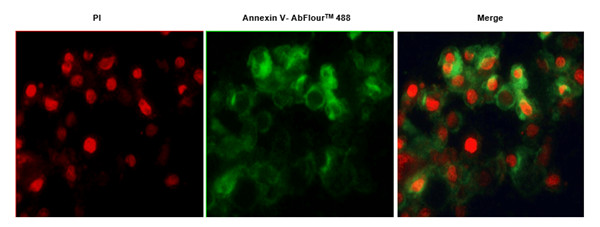 Abbkine AbFluor 488 细胞凋亡检测试剂盒特点及实验建议