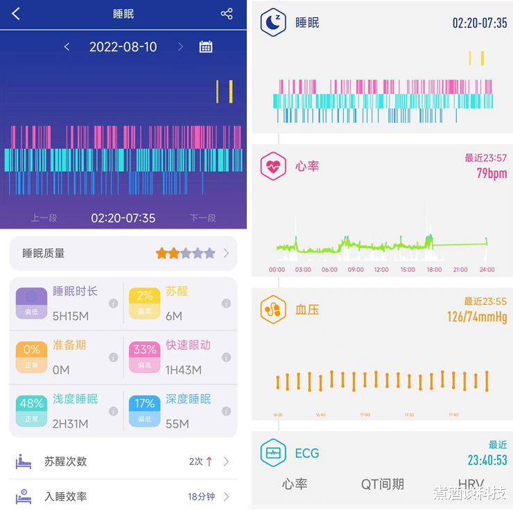 打印机|送媳妇的七夕礼物，dido G28S Pro心电血压智能手表，健康又实用