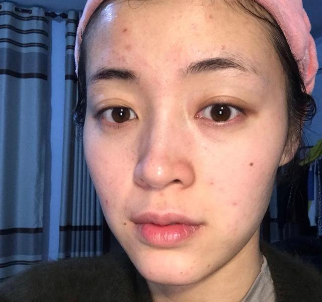 护肤品 判断你是“敏感肌”还是“伪敏感”，记住这几个明显特征，不会错