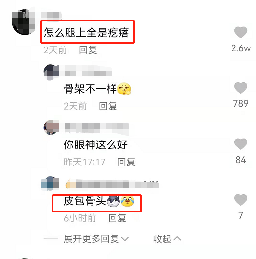 秦岚|42岁秦岚拍视频秀腿引众嘲，皮肤松垮加静脉曲张，热搜不要太尴尬