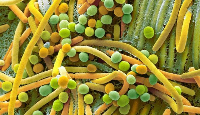 俄科学家:“国际空间站充满细菌微生物,可能会感染很多疾病。”