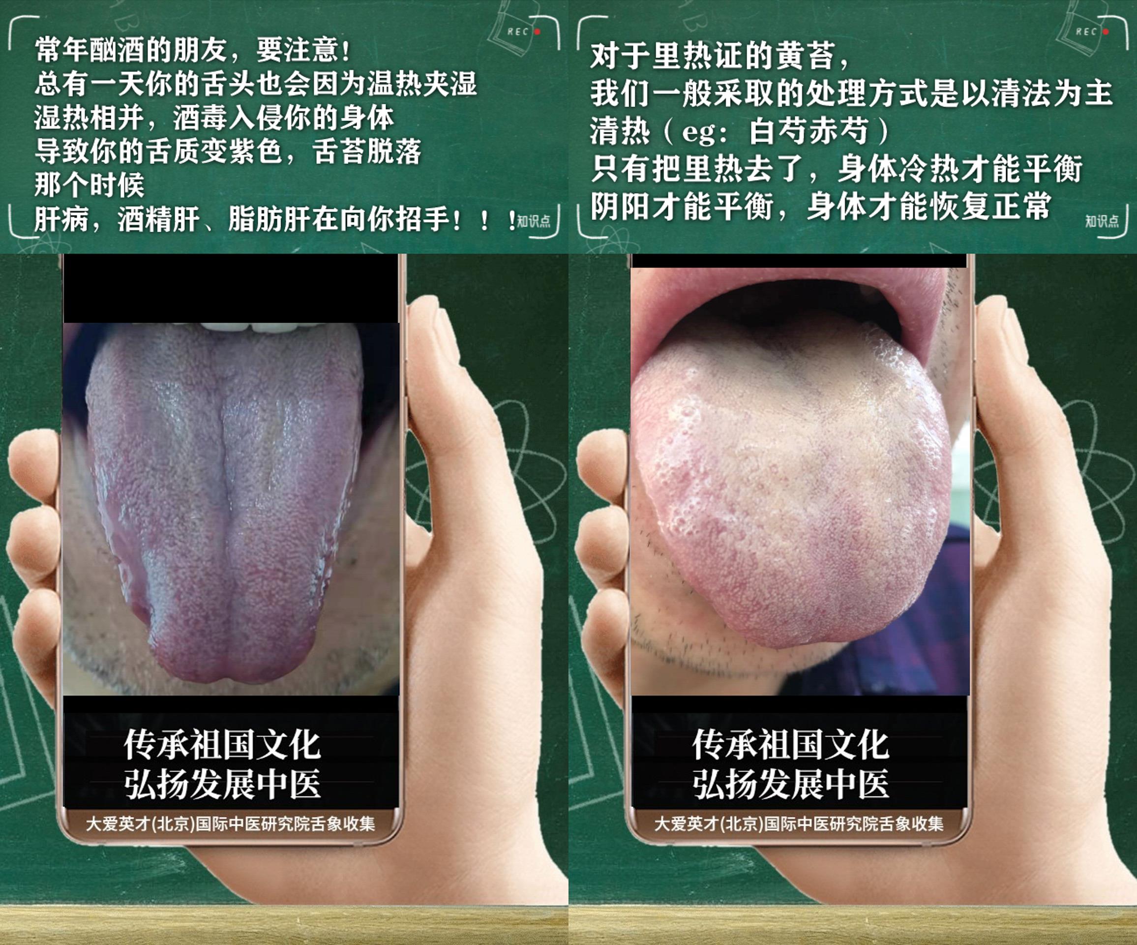 |中医分析：常悲伤，精神不振，胸闷痰多，反复不断非常难受