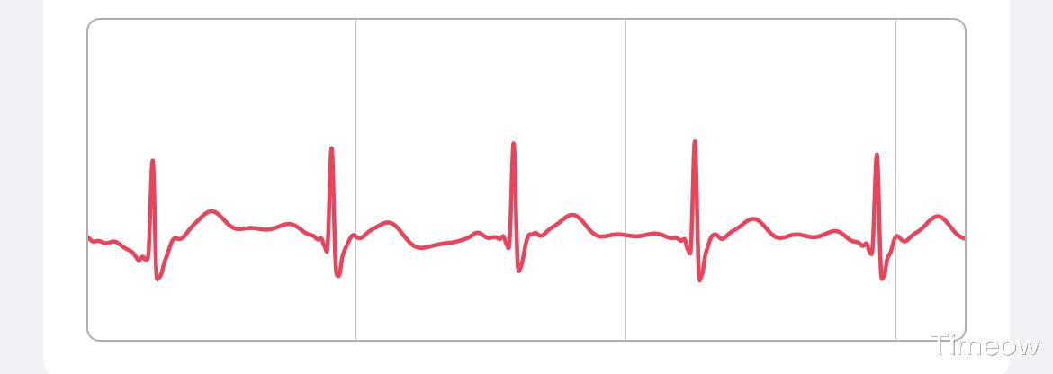 AMD|我 宅男 买了第二块运动表-Apple Watch S7